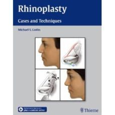 rhinoplasty: cases and techniques-michael s. godin-9781604066807