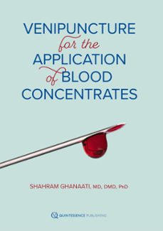 venipuncture for the application of blood concentrates (ebook)-9781647242107