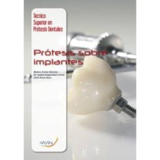 protesis sobre implantes (tecnico superior en protesis dentales)-9788416141807