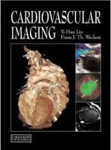 cardiovascular imaging-yi hwa liu-frans j. th wackers-9781840761917