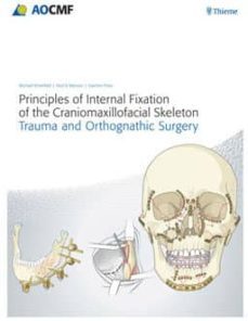 principles of internal fixation of the craniomaxillofacial skelet on: trauma and orthognathic surgery-9783131714817