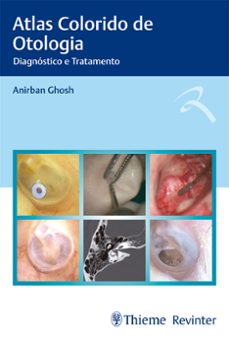 atlas colorido de otologia (ebook)-9786555722017