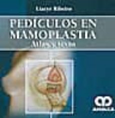 pediculos en mamoplastia. atlas y texto-lyacir ribeiro-9789588473017