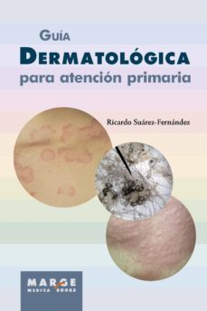 guia dermatologica para atencion primaria (ebook)-9788417313227