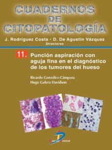 puncion aspiracion con aguja fina en el diagnostico de los tumores de hueso (ebook)-9788490520727
