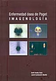 enfermedad osea de paget imagenologia-9788496792227
