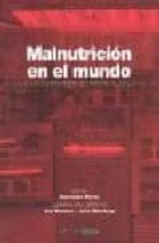 malnutricion en el mundo: como encontrar soluciones en el siglo x xi-ascension marco-9788493312237