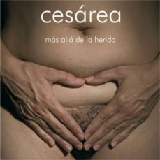cesarea: mas alla de la herida-ana alvarez errecalde-9788493752637