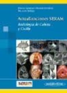 actualizaciones seram: radiologia de cabeza y cuello-9788498351637