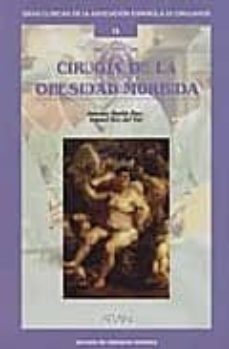cirugia de la obesidad morbida-antonio martin duce-9788486725747