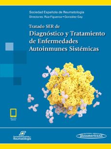 tratado ser de diagnostico y tratamiento de enfermedades autoinmu nes sistemicas (incluye acceso a ebook)-9788491102847
