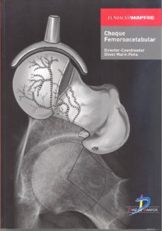 choque femoroacetabular (ebook)-oliver marin peña-9788499698847