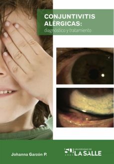 conjuntivitis alergicas (ebook)-johanna garzon p.-9789588939247