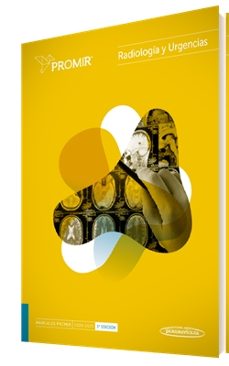 promir: radiologia y urgencias 2024-2025 (3ª ed.)-jesus corres gonzalez-9788411062657