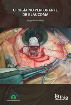 cirugia no perforante de glaucoma-sergio pinar sueiro-9788474297867