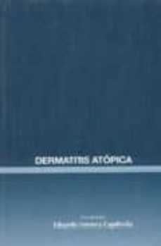 dermatitis atopica-eduardo fonseca capdevila-9788495033567