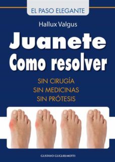 juanete - resolver sin cirugia (ebook)-gustavo guglielmotti-9788826004167