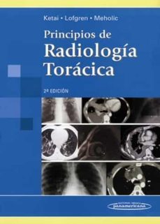 principios de radiologia toracica, 2ª ed.-9789500600767