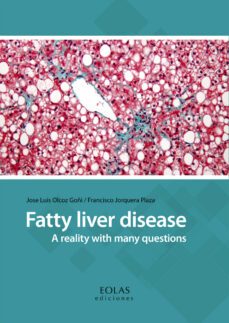 fatty liver disease-jose luis olcoz goñi-9788416613977
