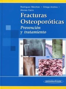 fracturas osteoporoticas: prevencion y tratamiento-9788479037987