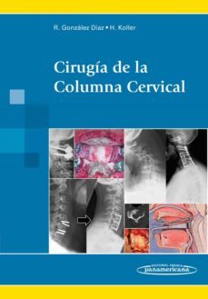cirugia de la columna cervical.-9788498358087