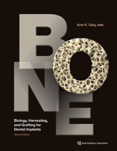 bone (ebook)-arun k. garg-9781647241797