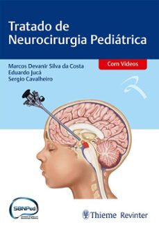 tratado de neurocirurgia pediatrica (ebook)-marcos devanir silva da costa-eduardo jucá-sergio cavalheiro-9786555723397
