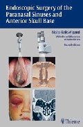 Endoscopic Surgery Of The Paranasal Sinuses And Anterior Skull Ba Se (2nd Ed) por M. Wigand