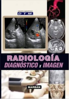Descargar mp3 gratis ebook RADIOLOGÍA DIAGNÓSTICO X IMAGEN