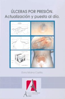 Ebook ita descarga gratuita epub ULCERAS POR PRESION: ACTUALIZACION Y PUESTA AL DIA (3ª ED.) 9788485539567 en español 